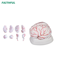 XC-308 دماغ مع الشرايين