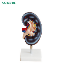 XC-310 سلسلة نموذج الكلى