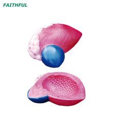 نموذج توسيع XC-317 من المثانة البولية