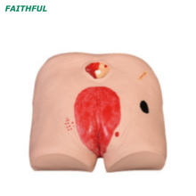 XC-459 نموذج رعاية قرحة Decubitus