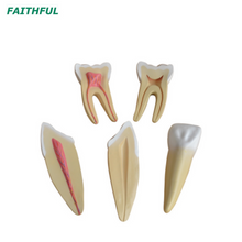 نموذج توسيع XC-305 لأسنان الإنسان