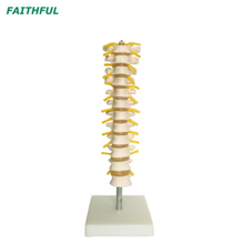 XC-120 العمود الفقري الصدري