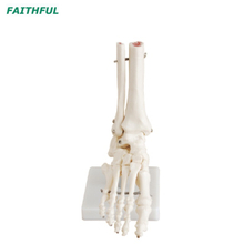 سلسلة مشترك القدم XC-113 